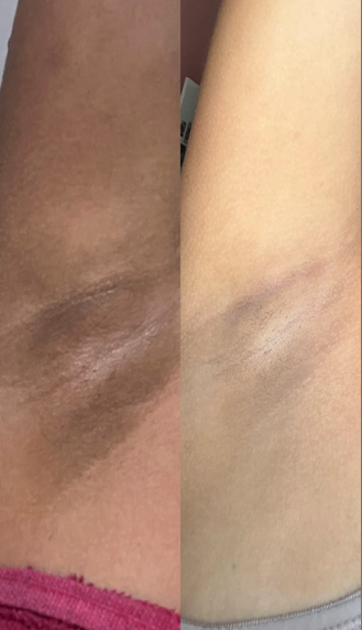 Duas fotos enviadas com o terceiro relato